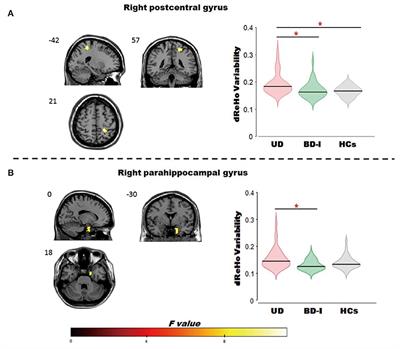 Differential Dynamical Pattern of Regional Homogeneity in Bipolar and Unipolar Depression: A Preliminary Resting-State fMRI Study